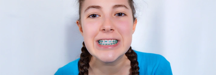 ORHTO – 1st Day Of Braces in Greeley CO ORHTO – 1st Day Of Braces in Greeley CO